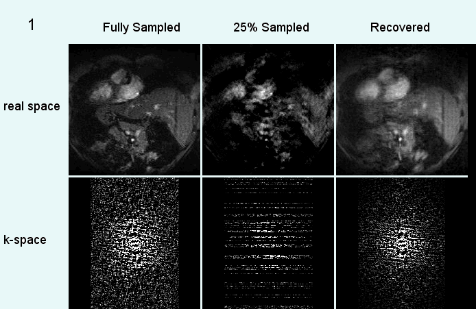 Original, sampled, and reconstructed MRI image sequence
